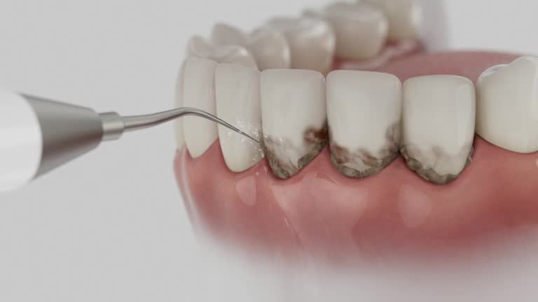 Trusted Dental Implants service in Crossville, TN - Dentist Open Now